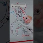 Звук Поноса И Диареи