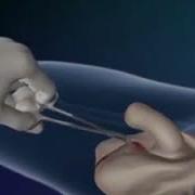 유두 개발 Asmr