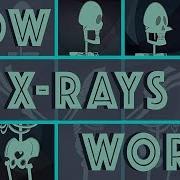 Xray