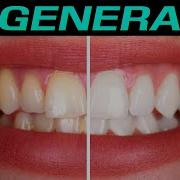 10000 Hz Full Restore Teeth Regeneration Regrowth Repair Frequencies