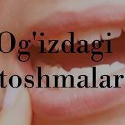 Огиздаги Тошмалар Og Izdagi Toshmalar