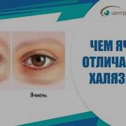 Белый Шарик На Веке