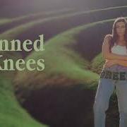 Emilee Moore Skinned Knees