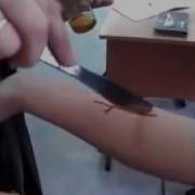 Учитель Порезал Ножом Руку Ученицы
