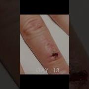 Заживают Раны У Меня Понял Ты