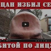 Видео Приколы 15 Пацан Избил Себя Битой По Лицу
