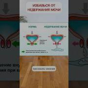 Матрица Горяева Импотенция